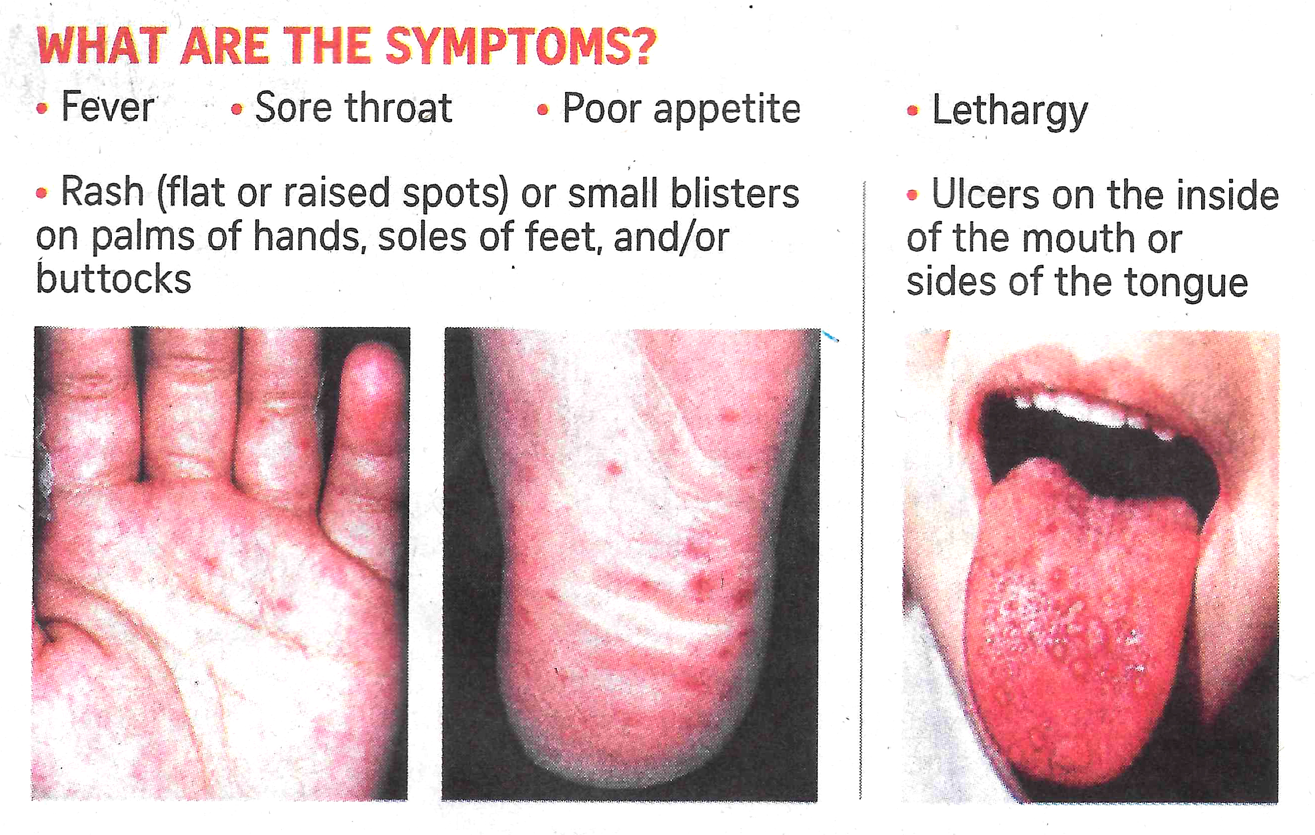 symptoms